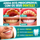 SmileBright™ — Pó Clareador Dental
