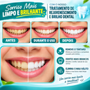 SmileBright™ — Pó Clareador Dental